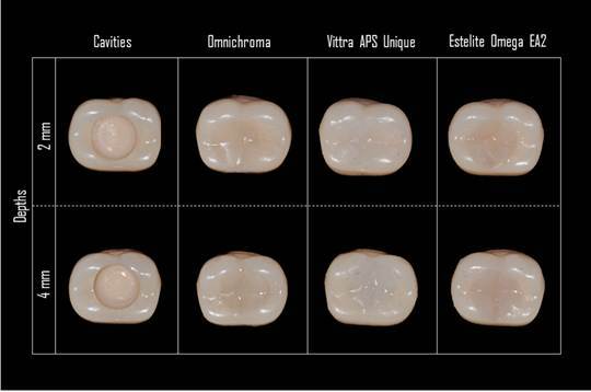 Influence of depth and translucency on the color matching of single-shade resin composites: An in vitro study.