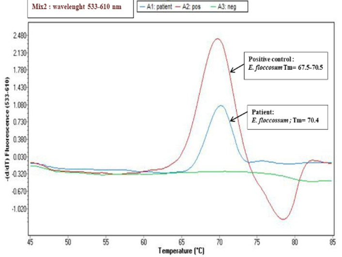 <i>Epidermophyton floccosum</i>, an etiological agent of tinea pedis and tinea unguium: about two cases.