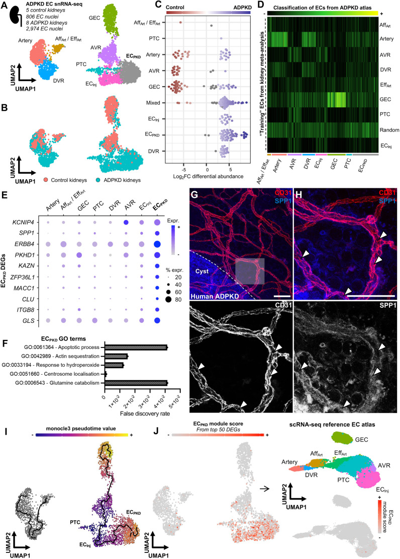 Microvascular aberrations found in human polycystic kidneys are an early feature in a Pkd1 mutant mouse model.