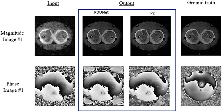 Complex-valued neural networks to speed-up MR thermometry during hyperthermia using Fourier PD and PDUNet.