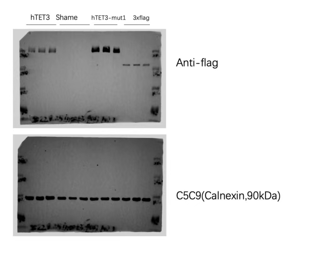 Molecular genetic testing and cohort analysis of 32 twin pairs with neurodevelopmental disorders-Reporting a novel de novo variant of TET3.