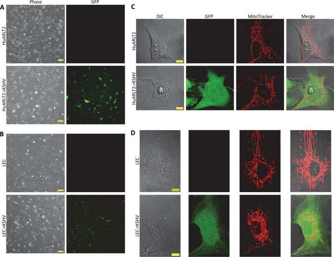Endothelial Cells Stably Infected with Recombinant Kaposi's Sarcoma-Associated Herpesvirus Display Distinct Viscoelastic and Morphological Properties.