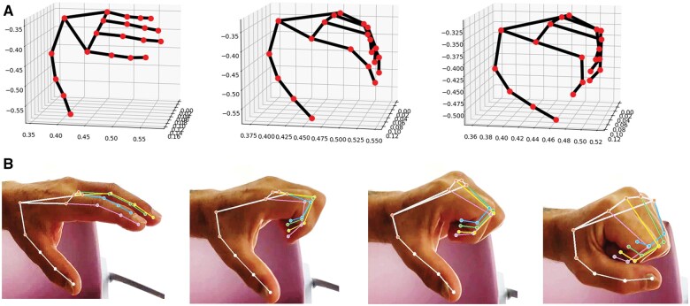 Single-camera motion capture of finger joint mobility as a digital biomarker for disease activity in rheumatoid arthritis.