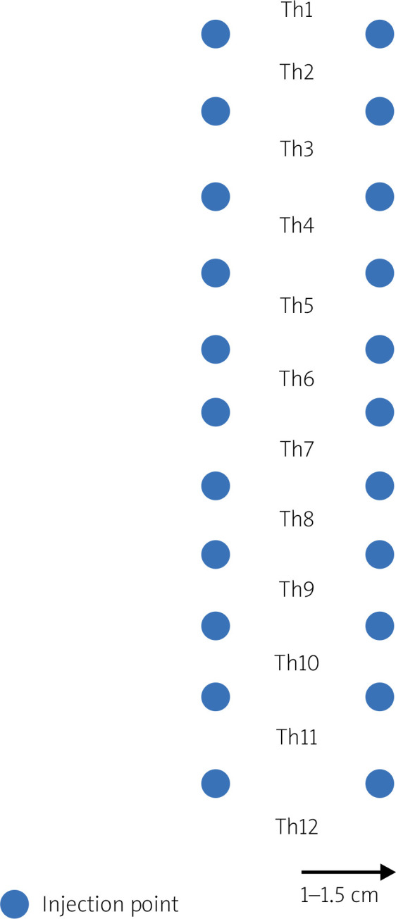 Spinal collagen mesotherapy in patients with chronic thoracic back pain: a retrospective analysis of effectiveness and safety in a 3-month follow-up.