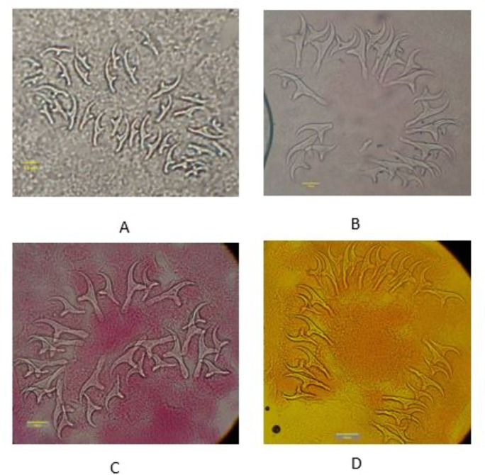 Differentiation of Cerebral Cystic Echinococcosis (CCE) from Coenurosis Using Morphometric and Molecular Methods.