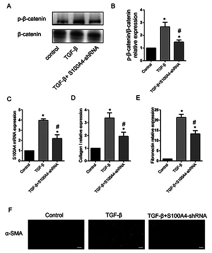 Downregulation of S100 calcium-binding A4 (S100A4) ameliorates hepatic fibrosis <i>via</i> regulating Wnt/β-catenin signaling pathway.