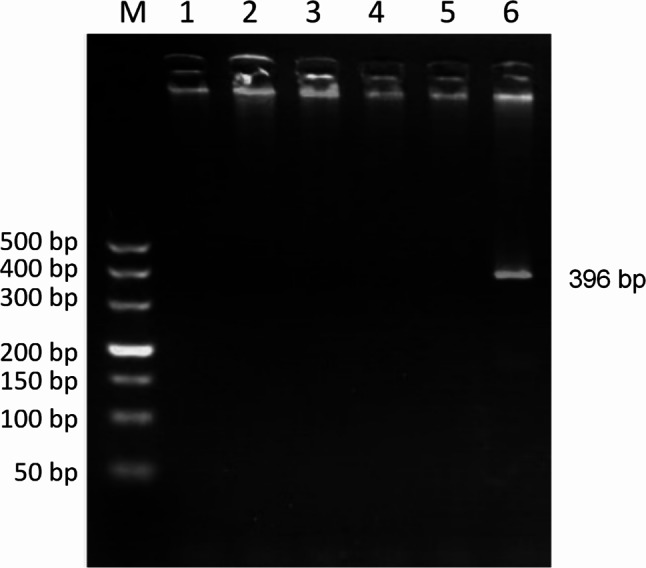Prevalence of Ehrlichia spp. in dogs and ticks in Hainan Province, China.