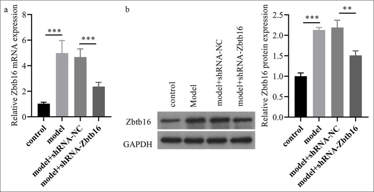 Zinc finger and broad-complex, tramtrack, and bric-a-brac domain containing 16 silencing attenuates bleomycin-induced pulmonary fibrosis in mice through inhibition of the phosphoinositide 3-kinase/protein kinase B/mammalian target of rapamycin pathway.