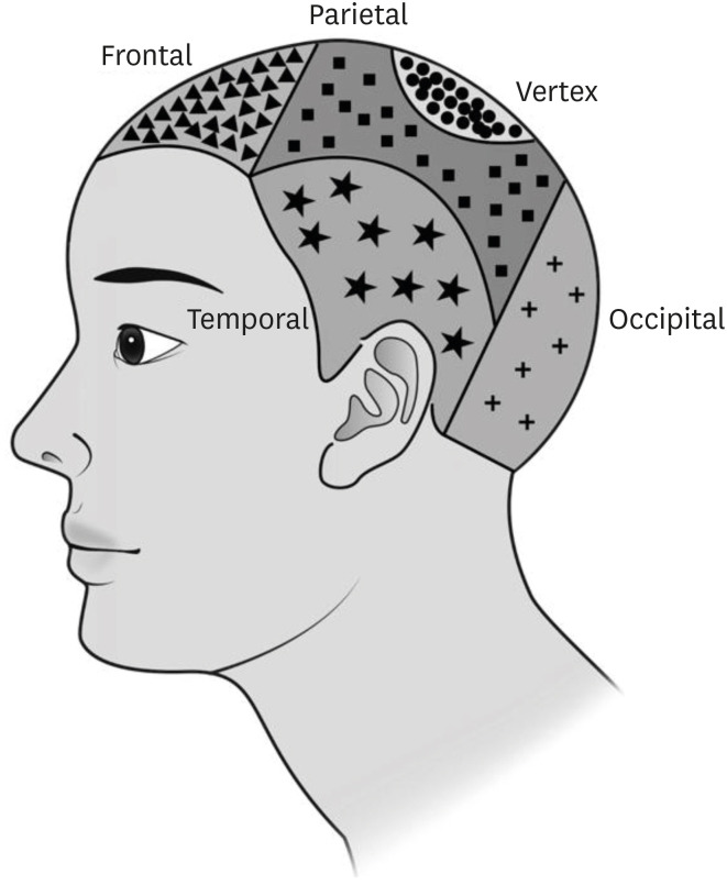 A Clinicopathologic Feature and Survival Analysis of Cutaneous Angiosarcoma: A Single Tertiary Center Study.