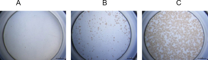 THE REPLICATION EFFICIENCY OF DENGUE VIRUS SEROTYPE 1 ISOLATED FROM PATIENTS WITH DENGUE FEVER IN HUMAN HEPATOCYTE CELL LINES.