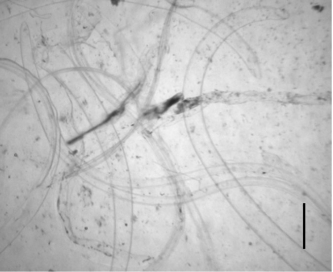 Immunogenicity of <i>Anisakis</i> larvae molting membrane against human eosinophilia sera.