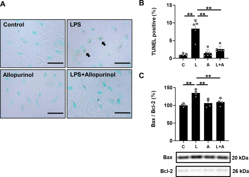 Allopurinol attenuates development of Porphyromonas gingivalis LPS-induced cardiomyopathy in mice.