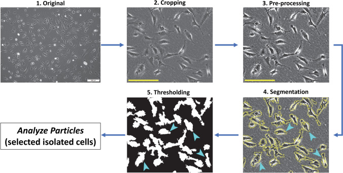 Endothelial Cells Stably Infected with Recombinant Kaposi's Sarcoma-Associated Herpesvirus Display Distinct Viscoelastic and Morphological Properties.