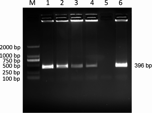 Prevalence of Ehrlichia spp. in dogs and ticks in Hainan Province, China.