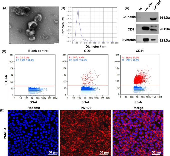 Exosomes derived from umbilical cord blood NK cells inhibit the progression of pancreatic cancer by targeting ROS-mediated mitochondrial dysfunction.