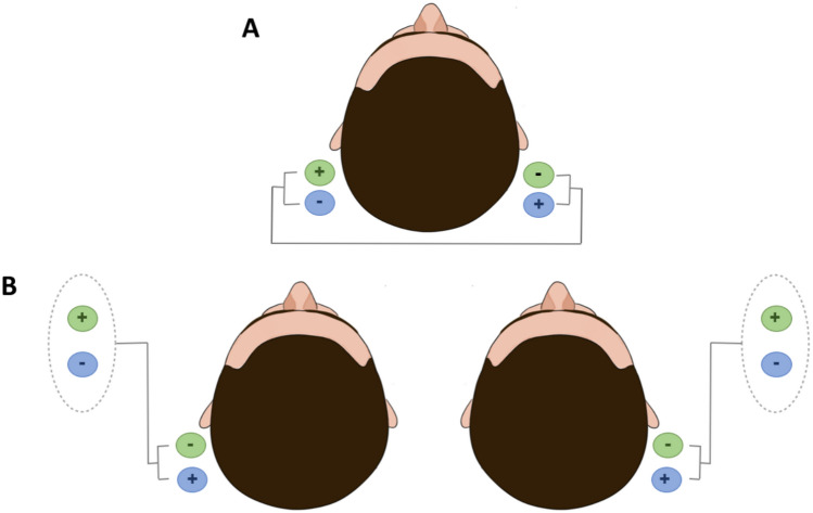 A wide-ranging review of galvanic vestibular stimulation: from its genesis to basic science and clinical applications.