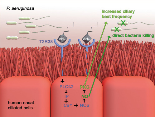 The impact of the bitter taste receptor on the predisposition to chronic rhinosinusitis.