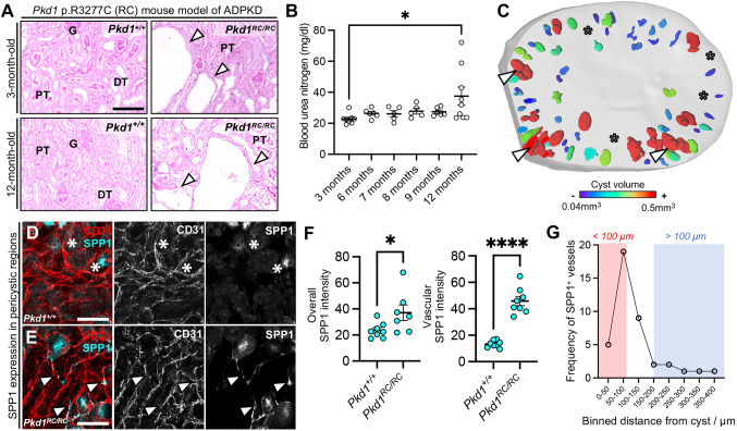 Microvascular aberrations found in human polycystic kidneys are an early feature in a Pkd1 mutant mouse model.