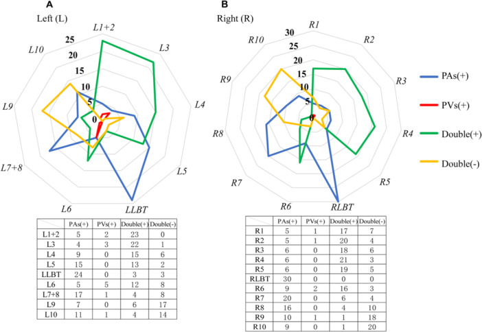 Pulmonary Artery Stent Implantation for Fibrosing Mediastinitis: Our Clinical Experience.