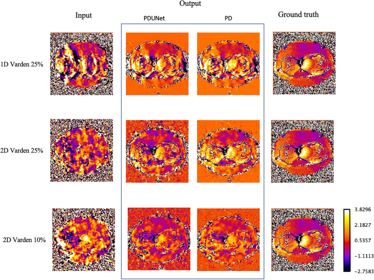 Complex-valued neural networks to speed-up MR thermometry during hyperthermia using Fourier PD and PDUNet.