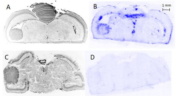 Autoradiography of Intracerebral Tumours in the Chick Embryo Model: A Feasibility Study Using Different PET Tracers.