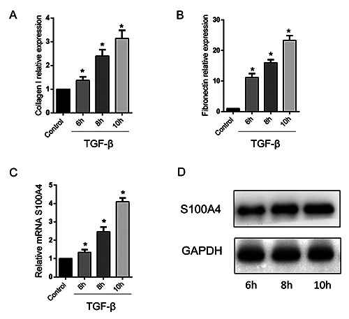 Downregulation of S100 calcium-binding A4 (S100A4) ameliorates hepatic fibrosis <i>via</i> regulating Wnt/β-catenin signaling pathway.