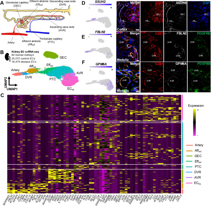 Microvascular aberrations found in human polycystic kidneys are an early feature in a Pkd1 mutant mouse model.