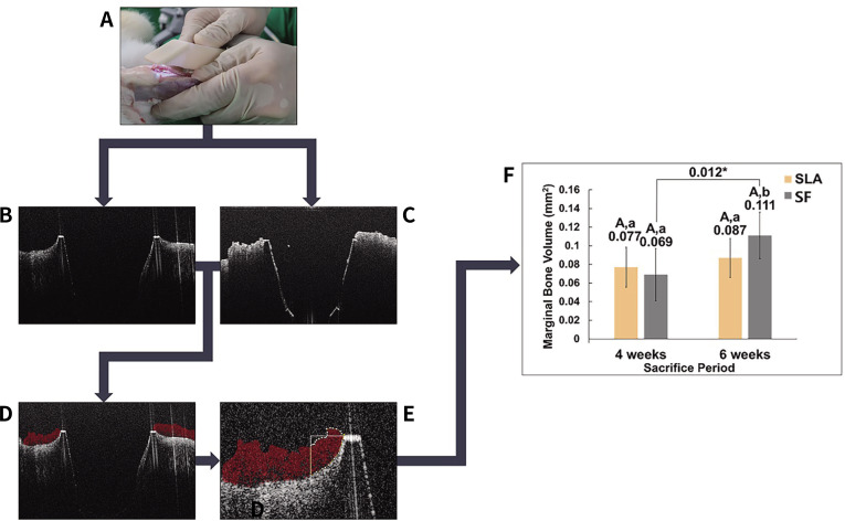 Effects of dental implant surface treated with sandblasting large grit acid-etching and femtosecond laser on implant stability, marginal bone volume, and histological results in a rabbit model.