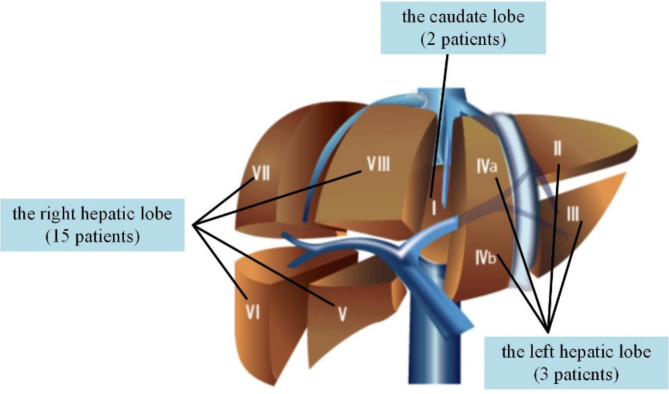 Dosimetric investigation of multi-parametric 4D-MRI for radiotherapy in liver cancer.