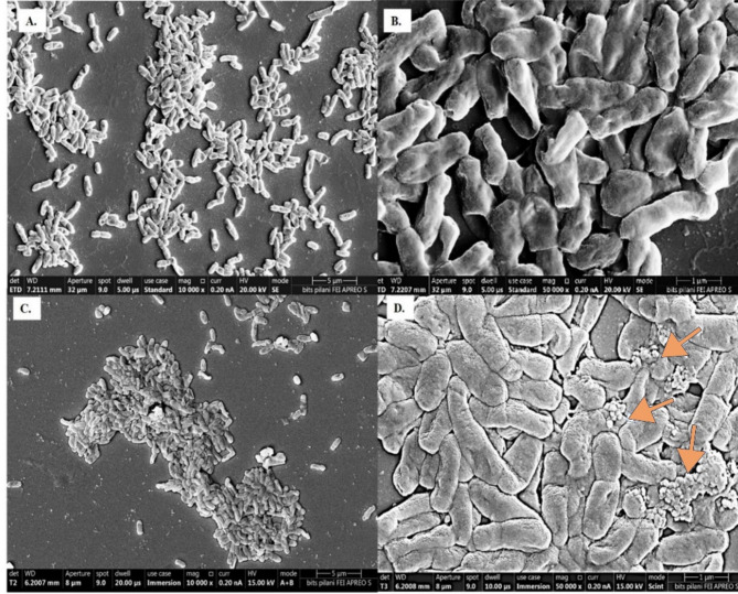 Metabolomic profiling of biphenyl-induced stress response of Brucella anthropi MAPB-9.