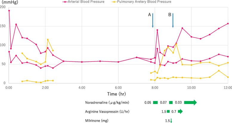 Severe pulmonary hypertension in weaning from cardiopulmonary bypass following double Ozaki procedure: a case report.