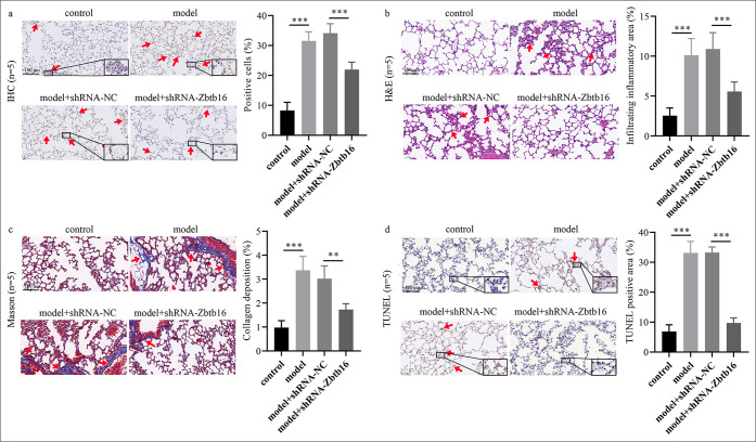 Zinc finger and broad-complex, tramtrack, and bric-a-brac domain containing 16 silencing attenuates bleomycin-induced pulmonary fibrosis in mice through inhibition of the phosphoinositide 3-kinase/protein kinase B/mammalian target of rapamycin pathway.