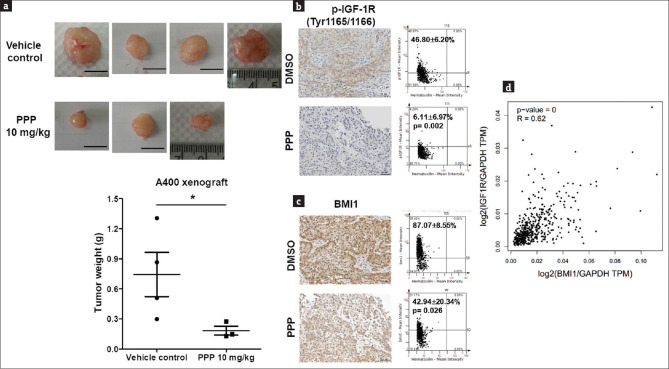 Reciprocal regulation between B lymphoma Mo-MLV insertion region 1 homolog and type I insulin-like growth factor receptor in pemetrexed-resistant lung cancer cells.