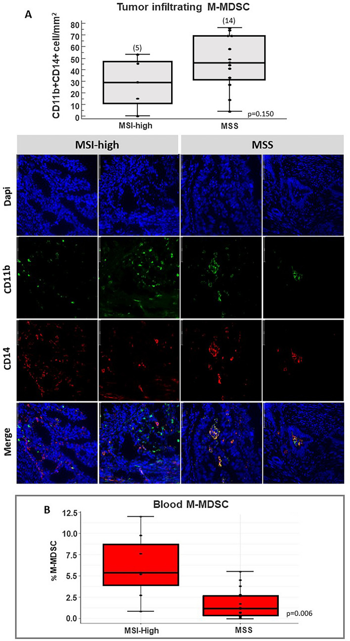 Association of peripheral monocytic myeloid-derived suppressor cells with molecular subtypes in single-center endometrial cancer patients receiving carboplatin + paclitaxel/avelumab (MITO-END3 trial).