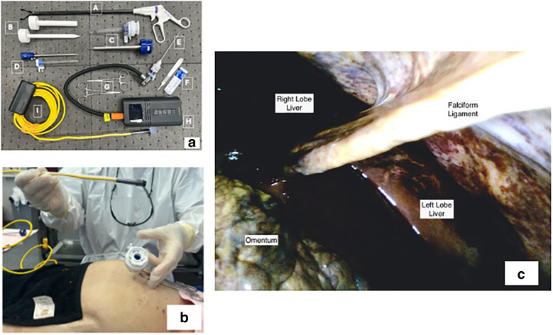 Building Bridges: The Homemade Laparoscope Project for Medical Education.