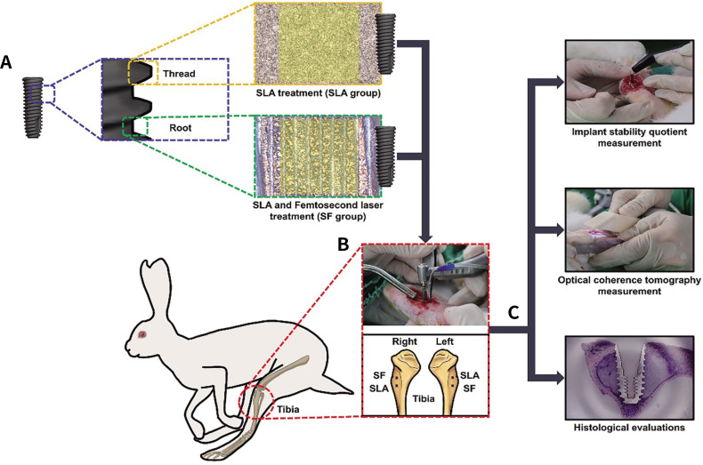 Effects of dental implant surface treated with sandblasting large grit acid-etching and femtosecond laser on implant stability, marginal bone volume, and histological results in a rabbit model.