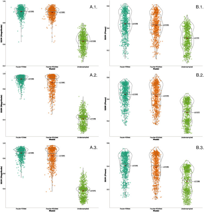 Complex-valued neural networks to speed-up MR thermometry during hyperthermia using Fourier PD and PDUNet.
