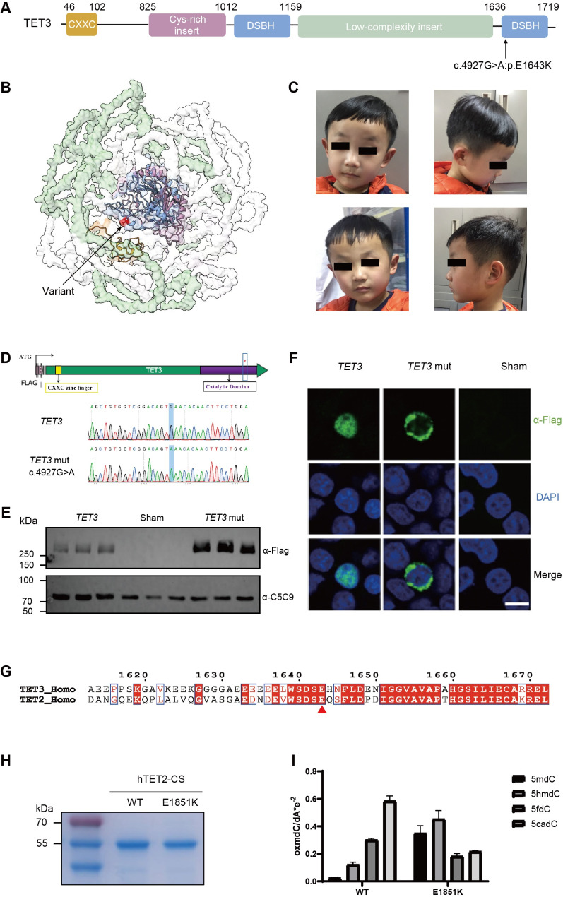 Molecular genetic testing and cohort analysis of 32 twin pairs with neurodevelopmental disorders-Reporting a novel de novo variant of TET3.