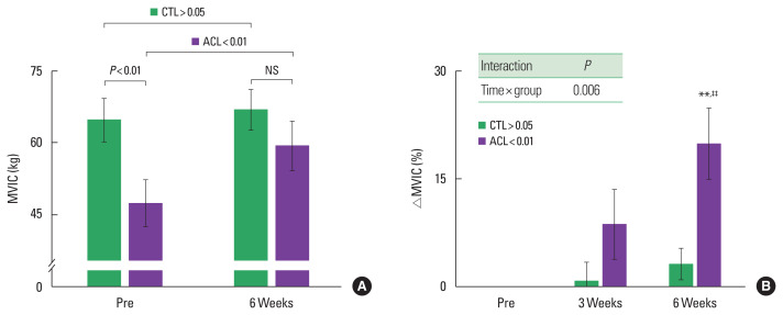 Effects of neuromuscular electrical stimulation on neuromuscular function and muscle quality in patient following anterior cruciate ligament reconstruction.