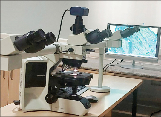 Histomorphometric evaluation of chitosan and concentrated growth factor reinforced bone following cystectomy - A case control study.