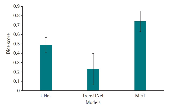 Comparative evaluation of deep learning architectures, including UNet, TransUNet, and MIST, for left atrium segmentation in cardiac computed tomography of congenital heart diseases.