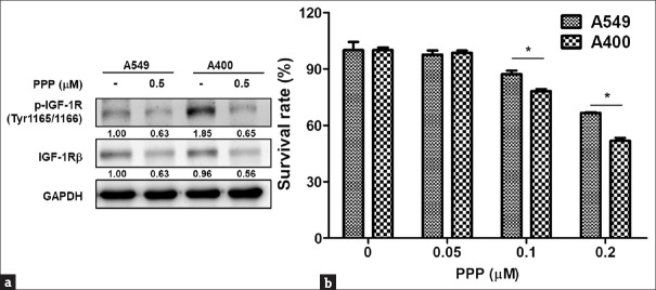 Reciprocal regulation between B lymphoma Mo-MLV insertion region 1 homolog and type I insulin-like growth factor receptor in pemetrexed-resistant lung cancer cells.