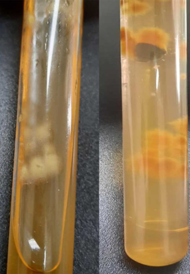 <i>Epidermophyton floccosum</i>, an etiological agent of tinea pedis and tinea unguium: about two cases.