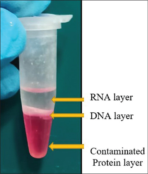 Effect of duration of fixation with formalin on mRNA expression using quantitative RT-PCR.