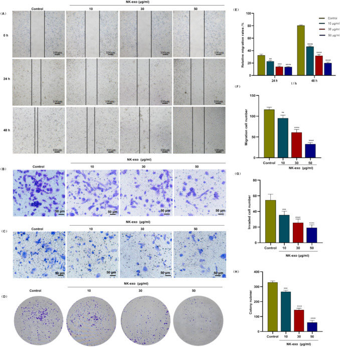 Exosomes derived from umbilical cord blood NK cells inhibit the progression of pancreatic cancer by targeting ROS-mediated mitochondrial dysfunction.
