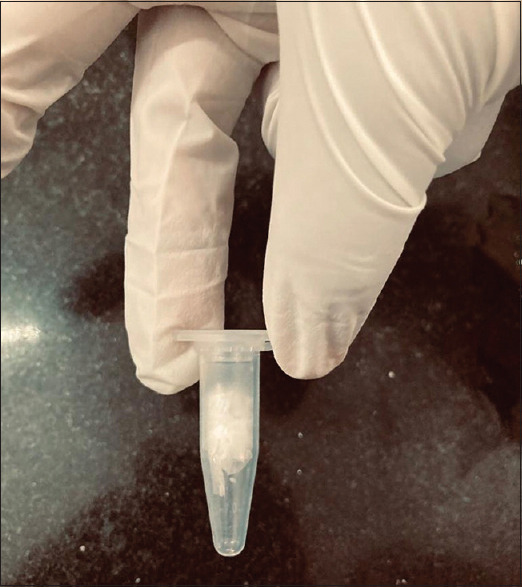 Effect of duration of fixation with formalin on mRNA expression using quantitative RT-PCR.