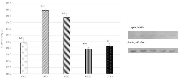 Impact of <i>Elateriospermum tapos</i> Supplementation on Leptin and Hypothalamic Signaling in Female Offspring of High-Fat Diet-Induced Obese.