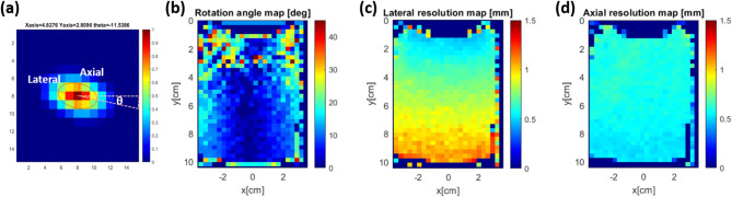 Contrast-ultrasound dispersion imaging for renal cell carcinoma diagnostics.