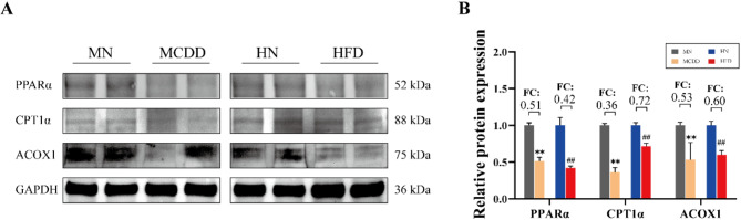 Differences in Fatty Acid Metabolism between MCDD and HFD Induced Metabolic Dysfunction-associated Fatty Liver Disease Model Mice.