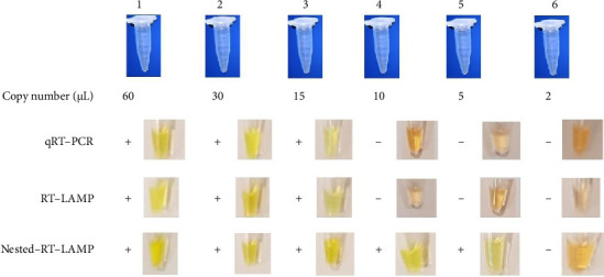 Development of a Novel Nested-RT-LAMP Assay for the Rapid and Accurate Coronavirus Disease-2019 Diagnosis.